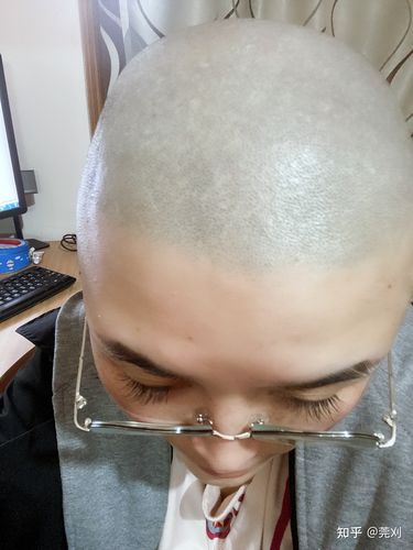新澳今晚特9点30开什么和因发量太多剃掉头发与因发量太多剃掉头发会怎么样